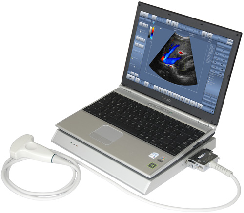 Mobile ultrasound collor dopler